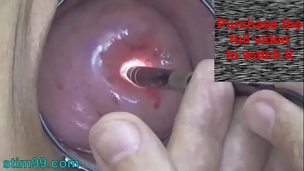 Tunjukkan Endoscope Camera inside Cervix Cam into Pussy Uterus Filem terbaik