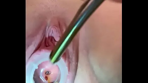 Show Painful cervix fucking 8mm best Movies